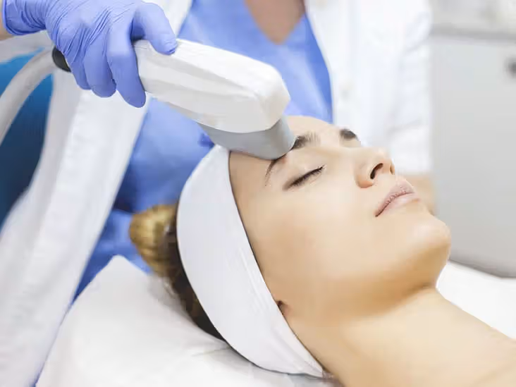 IPL Laser Treatment