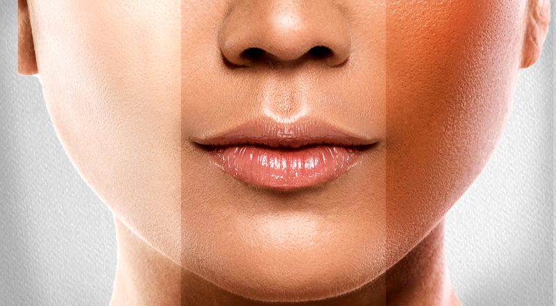 Safe and Effective Methods to Reduce Melanin and Achieve Clearer Skin