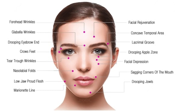 Areas that HIFU Targets in Mumbai at Revitalise Clinic