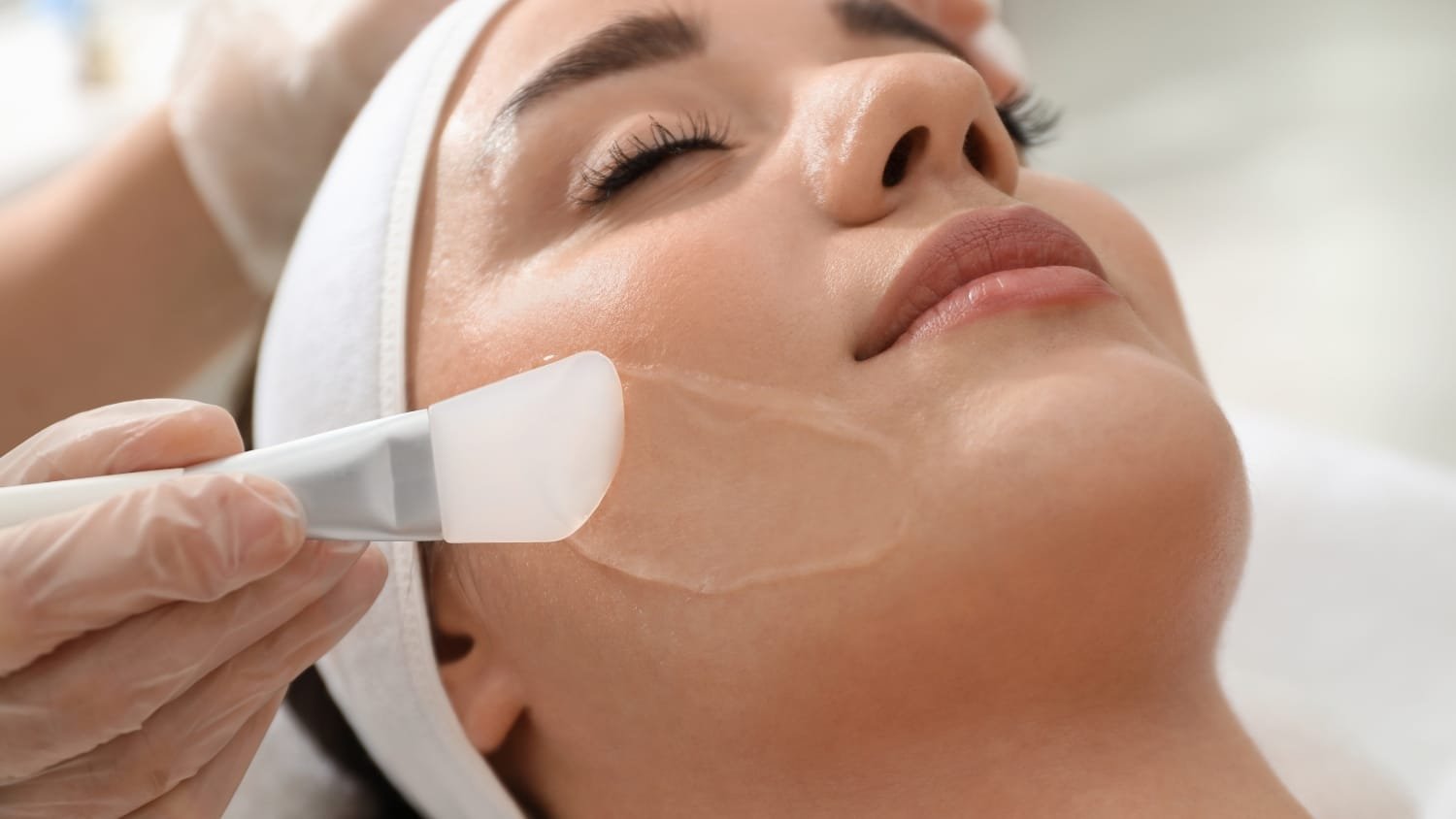 Chemical Peels for Skin Renewal