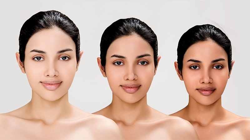 Skin Lightening Agents