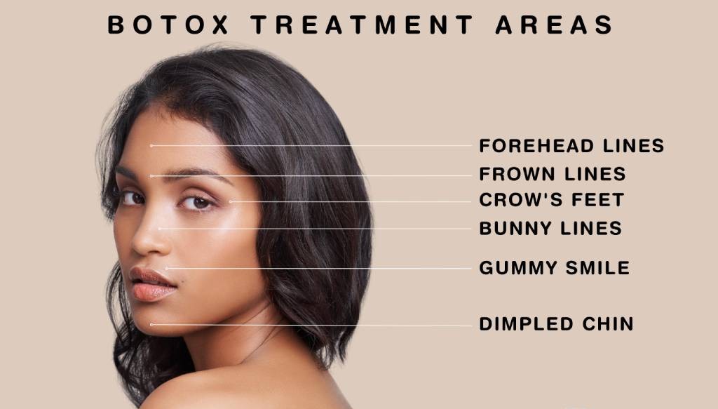 What is Botox Treatment?