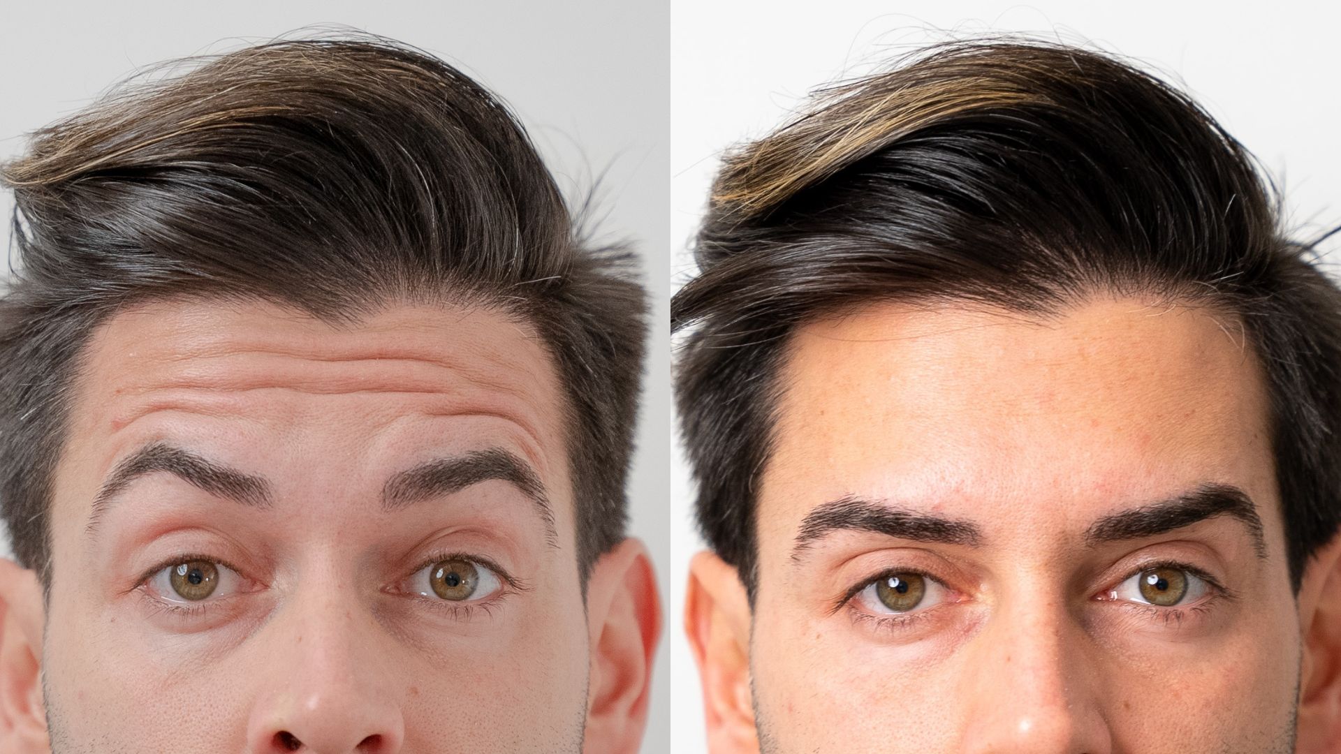 What Are Anti-Aging Injections?