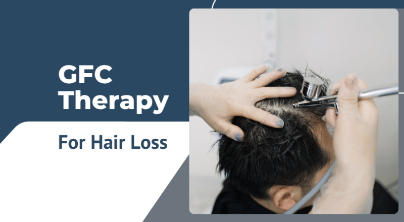 GFC Therapy for Hair Loss: Latest Innovation in Hair Restoration