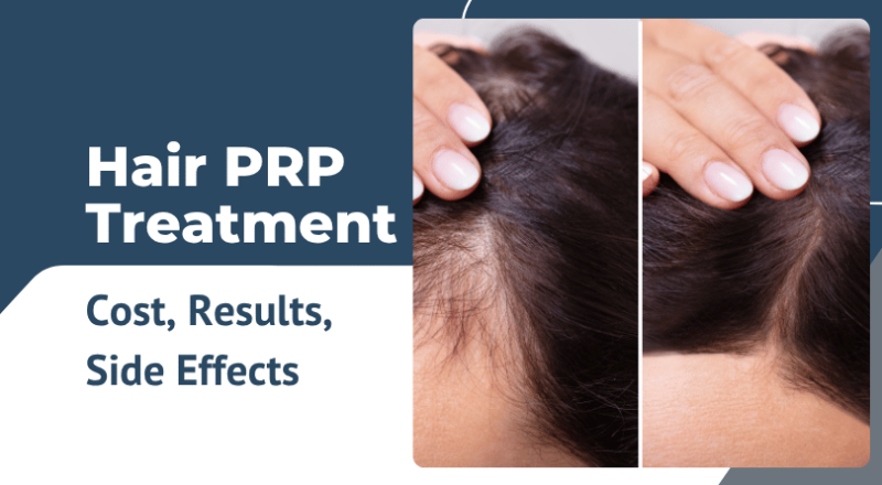 Hair PRP Treatment: Cost, Results, Side Effects