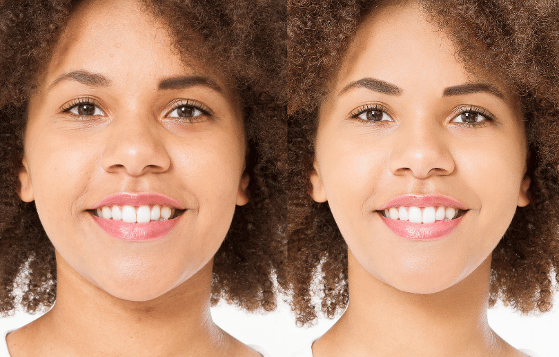 Expert Skin Tips to Maintain the Glow after Hydrafacial