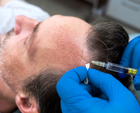 Why Should You Consider GFC and PRPTreatments?
