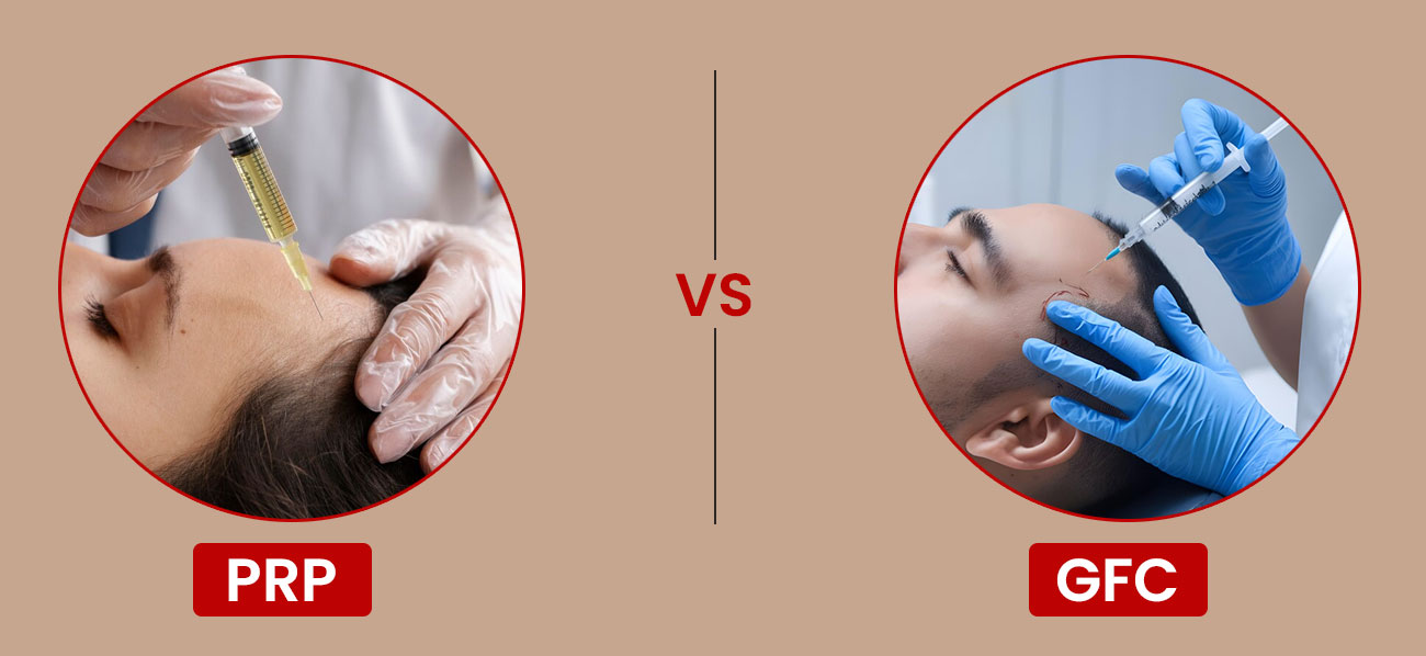 Understanding Hair PRP and GFC