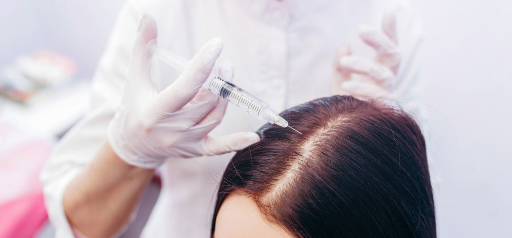 hair-loss-treatment