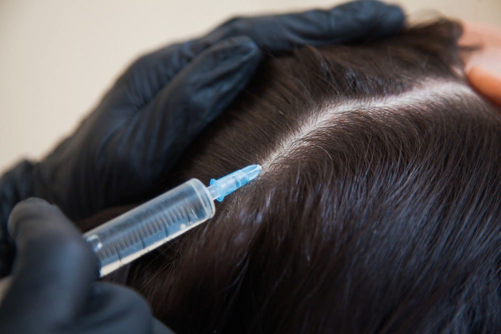 hair-growth-stimulation-treatment