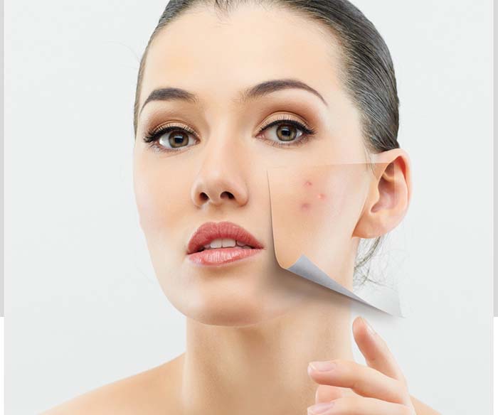 Acne & Pigmentation Treatment